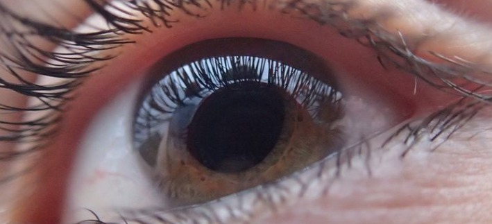 Jenis-jenis Penyakit Mata